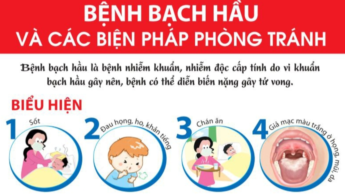 Hướng dẫn phòng, chống bệnh bạch hầu