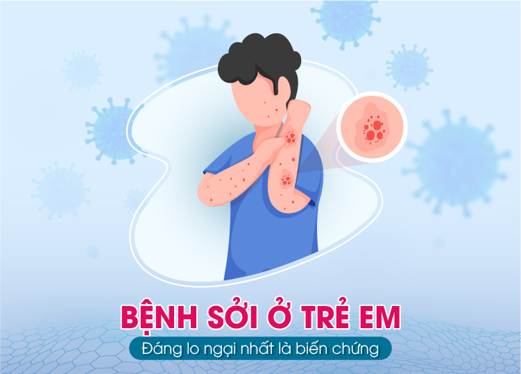 Tài liệu tuyên truyền về dịch Sởi